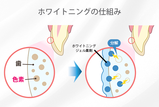 ホワイトニングの仕組み